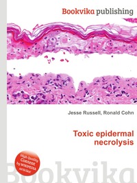 Jesse Russel - «Toxic epidermal necrolysis»