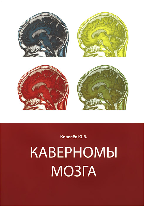 Ю. В. Кивелев - «Каверномы мозга»