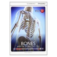 Diane Naughton - «Bones: And the Stories They Tell: Level A2+»
