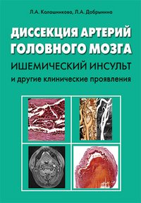 Л. А. Калашникова, Л. А. Добрынина - «Диссекция артерий головного мозга. Ишемический инсульт и другие клинические проявления»