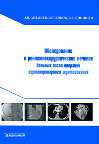 Обследование и рентгенохирургическое лечение больных после операции аортокоронарного шунтирования