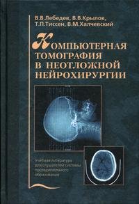 В. В. Крылов, В. В. Лебедев, Т. П. Тиссен, В. М. Халчевский - «Компьютерная томография в неотложной нейрохирургии»