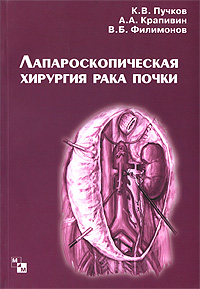 К. В. Пучков, А. А. Крапивин, В. Б. Филимонов - «Лапароскопическая хирургия рака почки»