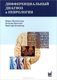 Марко Мументалер, Клаудио Бассетти, Кристоф Дэтвайлер - «Дифференциальный диагноз в неврологии»