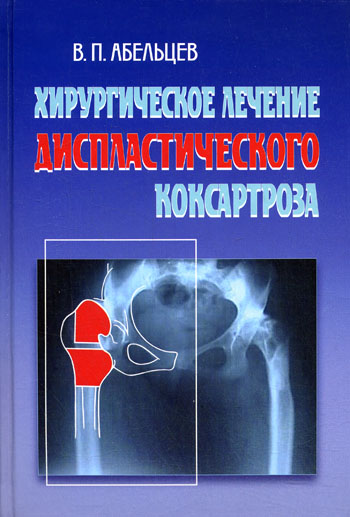 П. В. Абельцев - «Хирургическое лечение диспластического коксартроза»