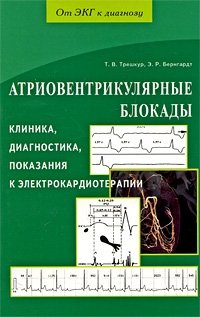 Т. В. Трешкур, Э. Р. Бернгардт - «Атриовентрикулярные блокады. Клиника, диагностика, показания в электрокардиотерапии»