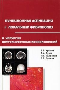 В. В. Крылов, С. А. Буров, И. Е. Галанкина, В. Г. Дашьян - «Пункционная аспирация и локальный фибринолиз в хирургии внутричерепных кровоизлияний»