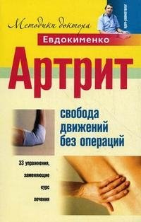 П. Евдокименко - «Артрит. Свобода движений без операций»