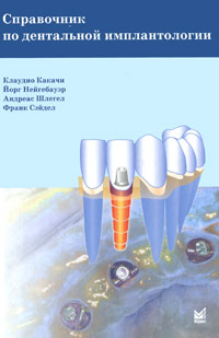 Справочник по дентальной имплантологии