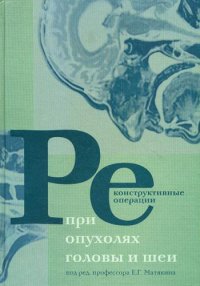 Под редакцией Е. Г. Матякина - «Реконструктивные операции при опухолях головы и шеи»