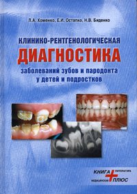Н. В. Биденко - «Стеклоиономерные материалы и их применение в стоматологии»