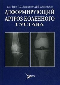 В. И. Зоря, Г. Д. Лазишвили, Д. Е. Шпаковский - «Деформирующий артроз коленного сустава»