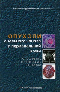 Ю. А. Шелыгин, М. И. Нечушкин, Е. Г. Рыбаков - «Опухоли анального канала и перианальной кожи»