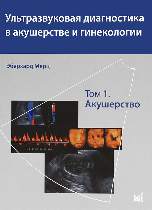 Эберхард Мерц - «Ультразвуковая диагностика в акушерстве и гинекологии. В 2 томах. Том 1. Акушерство»