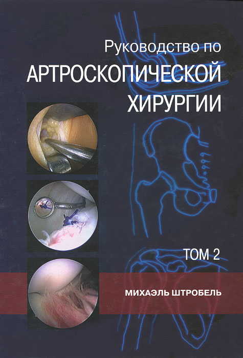 Руководство артроскопической хирургии. В 2 томах. Том 2