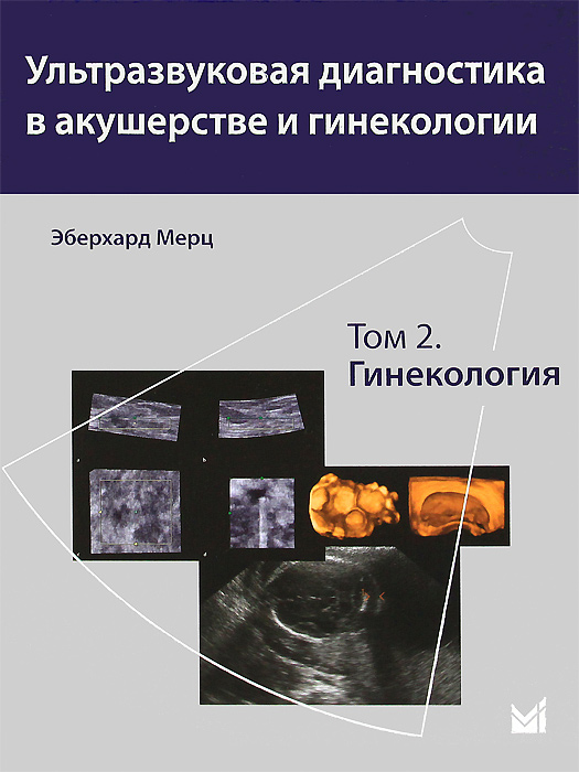 Эберхард Мерц - «Ультразвуковая диагностика в акушерстве и гинекологии. В 2 томах. Том 2. Гинекология»