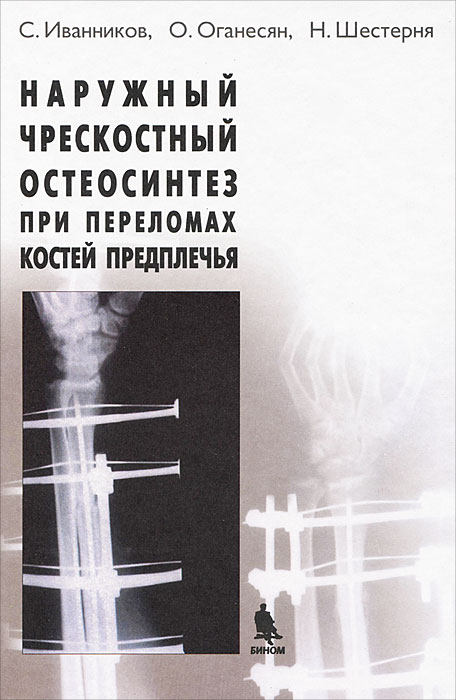 О. Оганесян, С. Иванников, Н. Шестерня - «Наружный чрескостный остеосинтез при переломах костей предплечья»