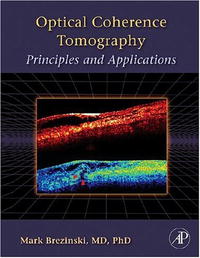 Mark E. Brezinski - «Optical Coherence Tomography: Principles and Applications»