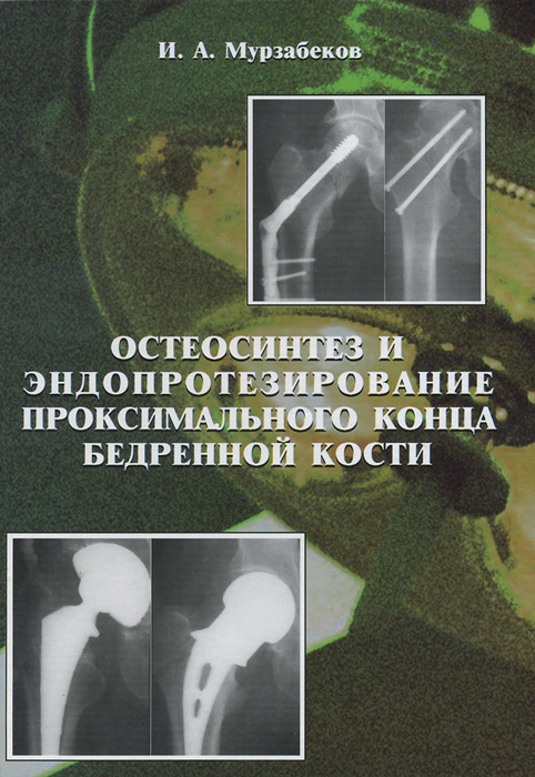 И. А. Мурзабеков - «Остеосинтез и эндопротезирование проксимального конца бедренной кости»