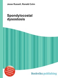 Jesse Russel - «Spondylocostal dysostosis»