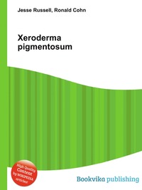Jesse Russel - «Xeroderma pigmentosum»