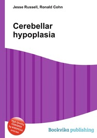 Cerebellar hypoplasia