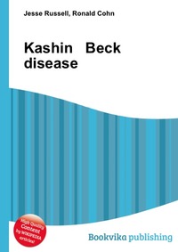 Jesse Russel - «Kashin Beck disease»