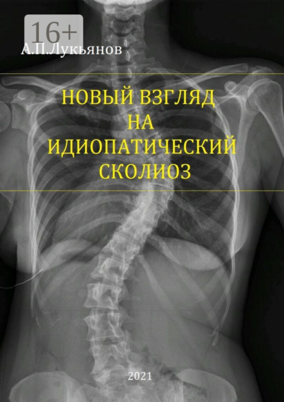 Книга Андрей Петрович Лукьянов Новый взгляд на идиопатический сколиоз