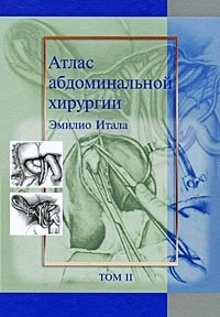 Книга Эмилио Итала Атлас абдоминальной хирургии. Том 2. Хирургия желудка и двенадцатиперстной кишки
