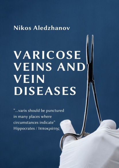 Книга Nikos Aledzhanov VARICOSE VEINS AND VEIN DISEASES