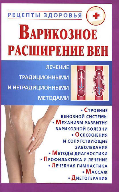 Книга Виктор Владимирович Горбунов, Виктор Горбунов Варикозное расширение вен. Лечение традиционными и нетрадиционными методами