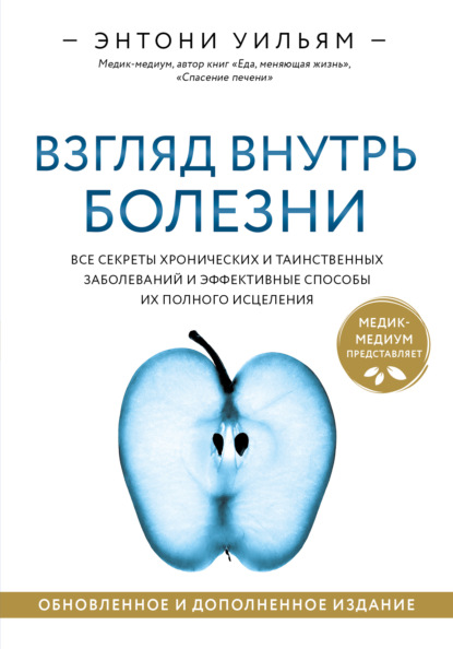 Книга Энтони Уильям, А. И. Гончар Взгляд внутрь болезни. Все секреты хронических и таинственных заболеваний и эффективные способы их полного исцеления
