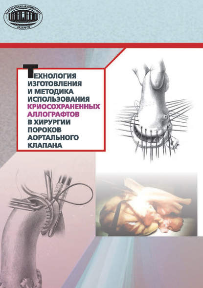 Книга Ю. П. Островский, Юрий Петрович Островский, Сергей Викторович Спиридонов, Ренат Муратович Муратов, Ольга Анатольевна Юдина Технология изготовления и методика использования криосохраненных аллографтов в хирургии пороков аортального клапана