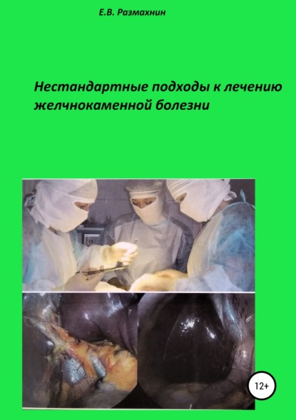 Книга Евгений Владимирович Размахнин Нестандартные подходы к лечению желчнокаменной болезни