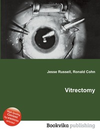 Vitrectomy