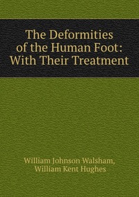 The Deformities of the Human Foot: With Their Treatment