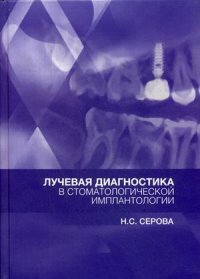 Лучевая диагностика в стоматологической имплантологии