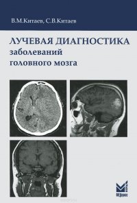 Лучевая диагностика заболеваний головного мозга