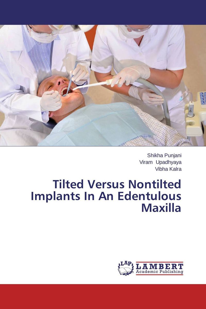 Tilted Versus Nontilted Implants In An Edentulous Maxilla