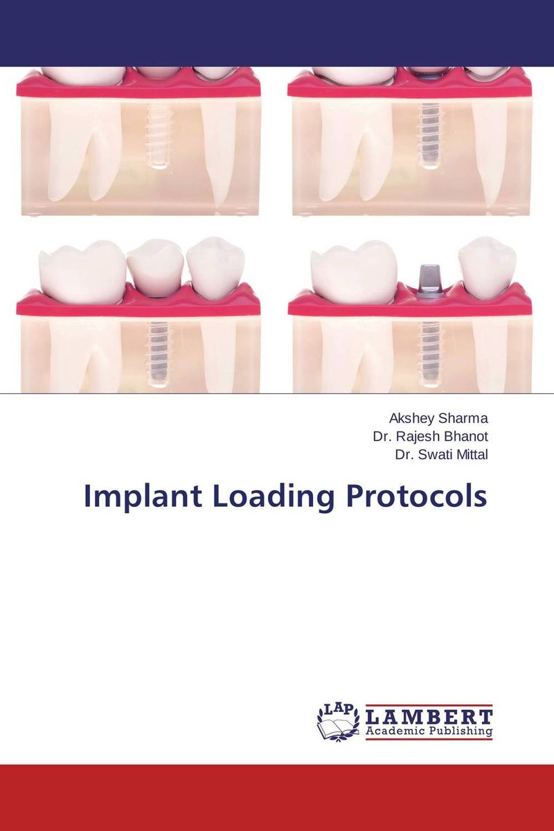  - «Implant Loading Protocols»