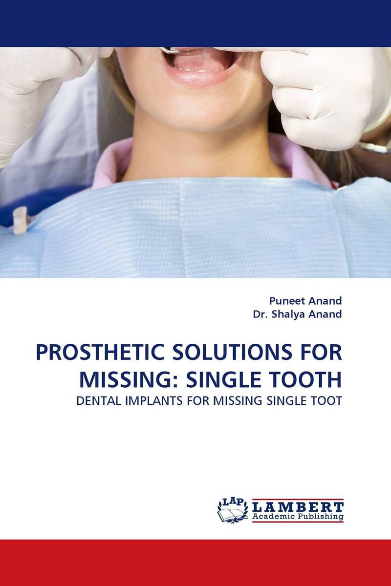 PROSTHETIC SOLUTIONS FOR MISSING: SINGLE TOOTH