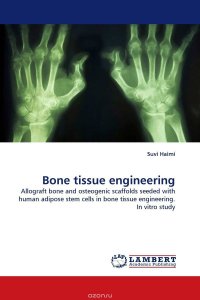 Bone tissue engineering