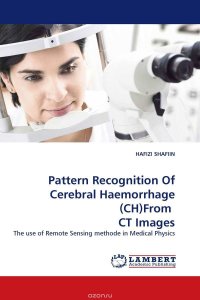 Pattern Recognition Of Cerebral Haemorrhage (CH)From CT Images