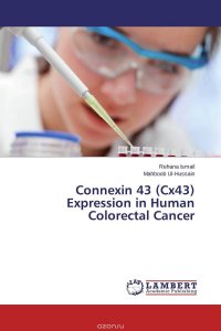 Connexin 43 (Cx43) Expression in Human Colorectal Cancer