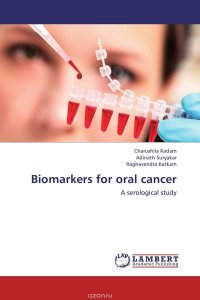 Biomarkers for oral cancer