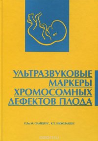 Ультразвуковые маркеры хромосомных дефектов плода