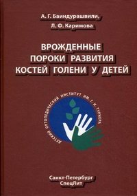 Врожденные пороки развития костей голени у детей