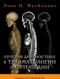 Лучевая диагностика в травматологии и ортопедии . Клиническое руководство