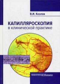 Капилляроскопия в клинической практике