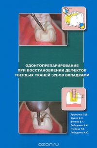 Одонтопрепарирование при восстановлении дефектов твердых тканей зубов вкладками